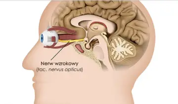 Przekrój głowy z okiem i nerwem wzrokowym. Czy zapalenie nerwu wzrokowego zawsze oznacza SM? Niekoniecznie, ale warto zbadać przyczynę.