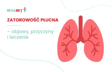 Zatorowość płucna: objawy, przyczyny i leczenie. Grafika przedstawia stylizowane płuca.