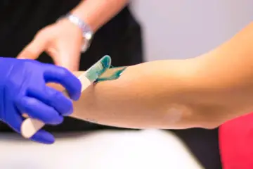 Specjalista nakłada wosk na rękę, przygotowując do depilacji. Jaka długość włosów do depilacji woskiem jest optymalna?