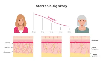 Wykres pokazuje, co daje kolagen: jego ilość spada z wiekiem, co wpływa na wygląd skóry.