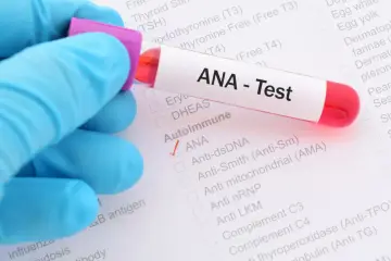 Ręka w niebieskiej rękawiczce trzyma probówkę z krwią do testu ANA. Na formularzu zaznaczono ANA.