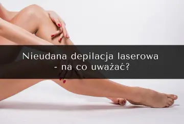 Nogi po nieudanej depilacji laserowej. Brak efektów, a może coś poszło nie tak?