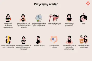 Przyczyny wzdęć: jedzenie produktów wzdymających, przejadanie się, połykanie powietrza, siedzący tryb życia, nietolerancja pokarmowa, stres, zmiany hormonalne, ciąża, dysbakterioza jelitowa, choroby przewodu pokarmowego, patologie układu rozrodczego.