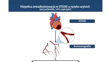 Schemat przedstawia serce, naczynia wieńcowe i proces koronarografii. Temat: niepełna rewaskularyzacja w STEMI.