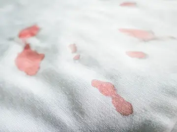 Plamy z krwi na białej pościeli? Dowiedz się, jak usunąć plamy z krwi z pościeli żeby nie został po nich żółty ślad.