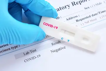 Rękawiczka w niebieskiej rękawiczce trzyma test na COVID-19 z negatywnym wynikiem. Zastanawiasz się, ile kosztuje test na covid?