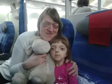 Kobieta i dziecko z zespołem Crouzona siedzą w samolocie, przytulając pluszową owieczkę.