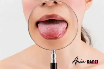 Powiększony pypeć na języku pod lupą.