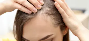 Dłonie kobiety dotykają jej głowy, sprawdzając cienkie włosy i delikatne baby hair przy linii czoła.