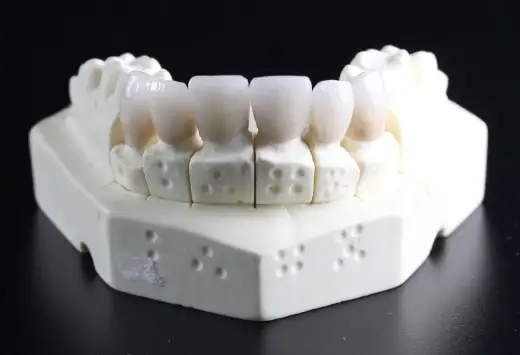 Brak zęba - jak zamaskować i kiedy do dentysty?