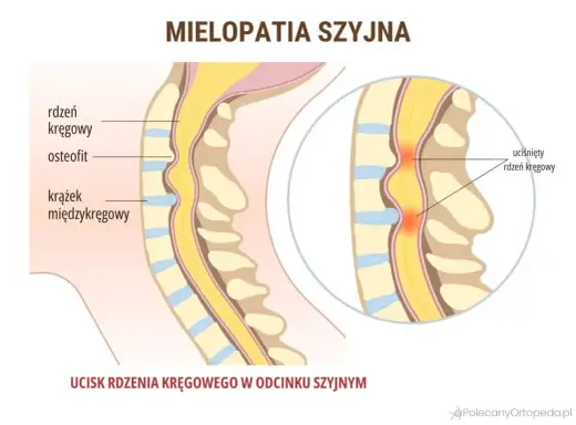 Drętwienie barku - nerw, szyja czy staw? Rozwiąż zagadkę!