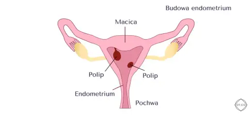 Endometrium - grubość, normy, ciąża. Kiedy USG niepokoi?