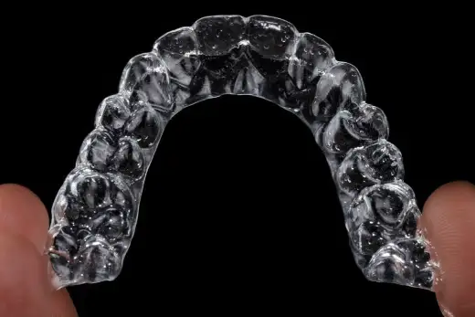 Invisalign - czy warto? Koszt, efekty i wady przezroczystych nakładek