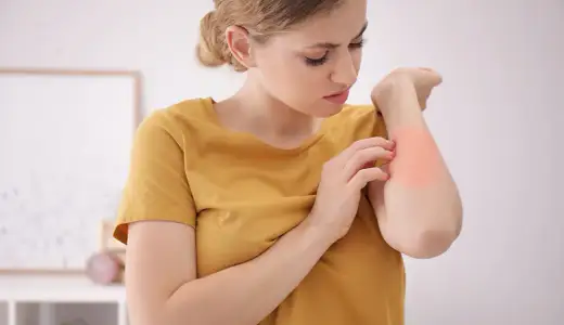 Alergia na roztocza: objawy skórne, AZS i jak sobie z nimi radzić