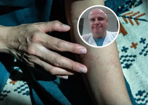 Dermatolog czy onkolog? Gdzie iść z niepokojącym znamieniem?
