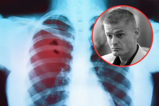 Objawy raka płuca - Kiedy kaszel to sygnał alarmowy?