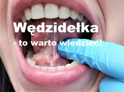 Kiedy zacząć ćwiczyć po podcięciu wędzidełka, aby uniknąć problemów?