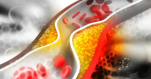 Tulip (atorwastatyna) - Jak stosować lek na cholesterol?