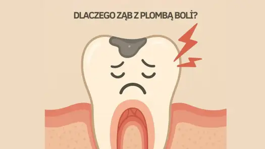 Ból zęba miesiąc po plombowaniu - Czy to normalne? Sprawdź!