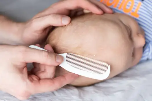Ciemieniucha u niemowląt - jak ją rozpoznać i kiedy do pediatry?