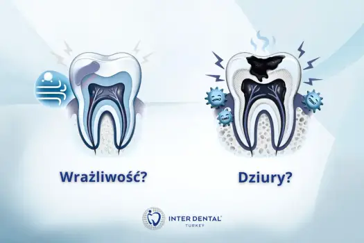 Ból zęba przy gryzieniu? To nie nadwrażliwość! Sprawdź, co oznacza