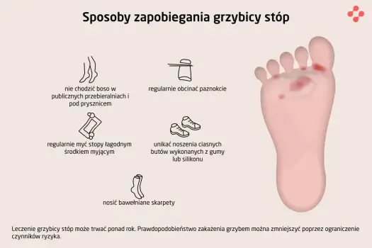 Grzybicze zmiany skóry - Jak rozpoznać, leczyć i unikać nawrotów?