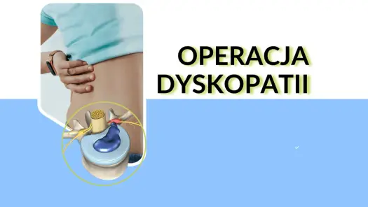Dyskopatia - kiedy operacja, a kiedy rehabilitacja?
