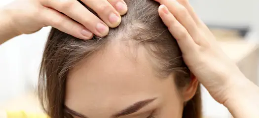 Baby hair przy linii włosów - jak je ułożyć bez efektu hełmu