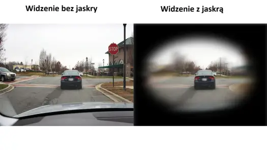 Jaskra - Jak zmienia się widzenie - Zobacz symulację