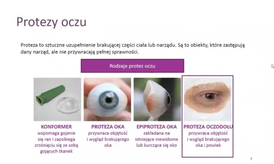 Proteza oka - jak wybrać, dbać i uzyskać refundację?