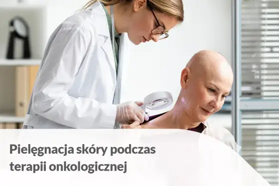 Radiocalm - ulga dla podrażnionej skóry po radioterapii? Sprawdź!