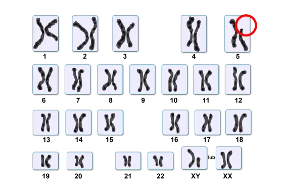 Ile chromosomów ma człowiek? 46, wyjątki i znaczenie kariotypu