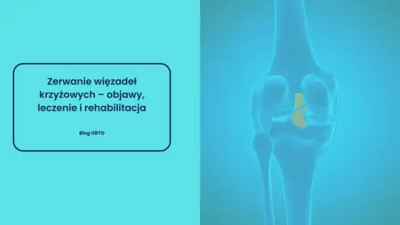 Czy zerwane więzadło boli - Dlaczego ból bywa mylący? Poznaj objawy