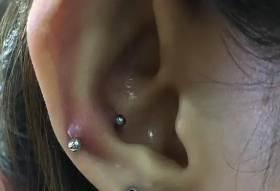Snug piercing - czy to dla Ciebie? Gojenie, biżuteria, cena