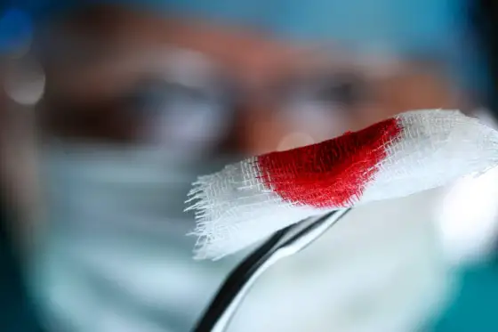 Plamienie implantacyjne - Jak wygląda i czym różni się od okresu?