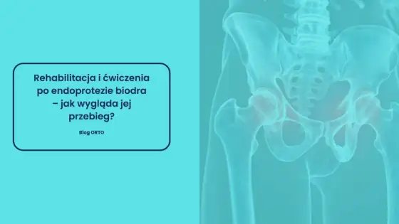 Rehabilitacja po endoprotezie biodra - Jak uniknąć błędów?