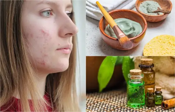 Grano ciego - Qué hacer para bajar inflamación y evitar marcas