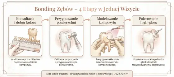 Bonding zębów - Czy szkodzi szkliwu? Poznaj fakty!