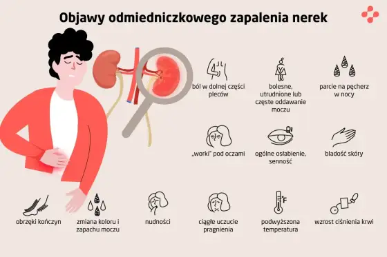 Objawy chorób nerek - Kiedy brak bólu myli? Sprawdź!