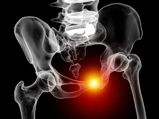 Douleur au pubis hors grossesse - Causes et solutions efficaces