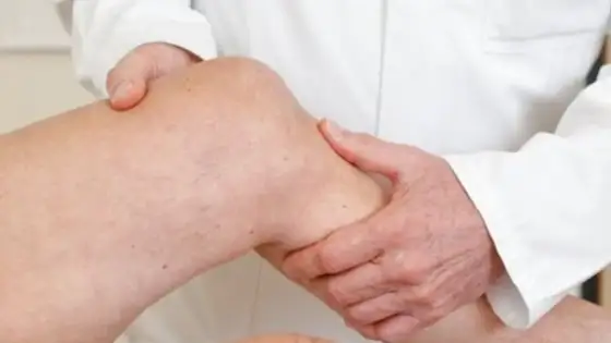 Sarkom-Symptome erkennen - Wann Sie handeln müssen