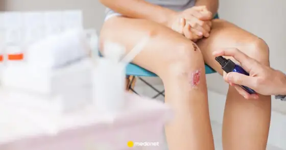 Solcoseryl - żel na skórę czy do oczu? Uniknij pomyłek!