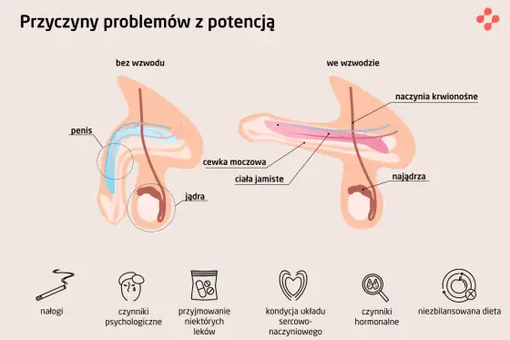 Zaburzenia erekcji - Skąd się biorą i jak je skutecznie leczyć?