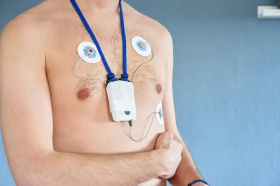 Holter EKG - Co naprawdę musisz wiedzieć? Poradnik