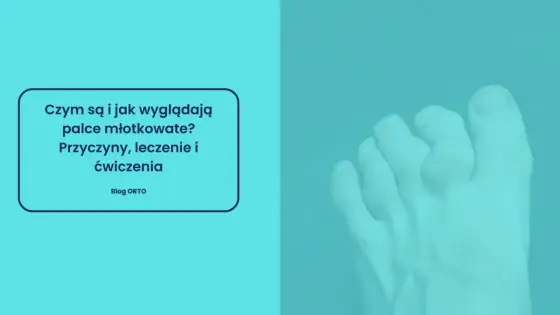 Palce młotkowate - kiedy pomagają ćwiczenia, a kiedy operacja?
