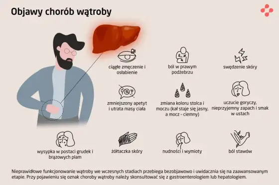 Zapalenie wątroby - objawy, badania i leczenie krok po kroku