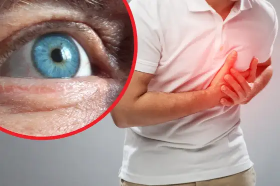 Angiopatia oka - Czy Twoje naczynia są bezpieczne?