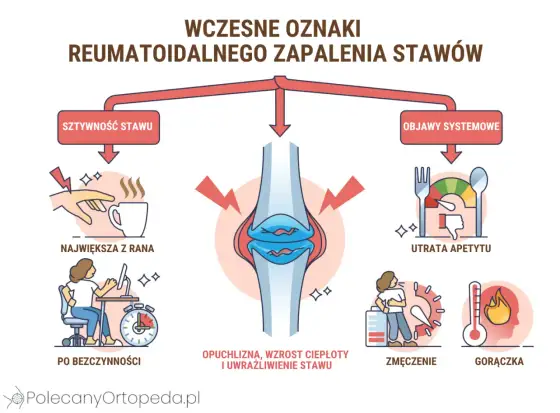 Wędrujące zapalenie stawów - skąd się bierze i jak je rozpoznać?