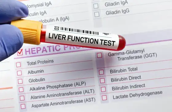 Podwyższone ALT - Co oznacza i jak obniżyć?