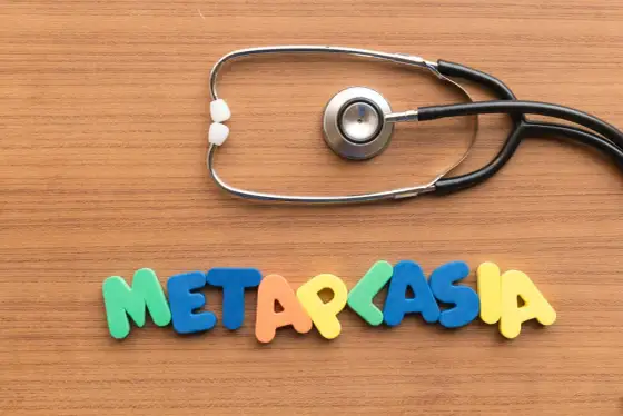 Metaplazja jelitowa w żołądku - co oznacza i kiedy kontrolować?